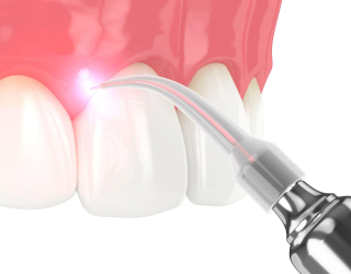 dent1