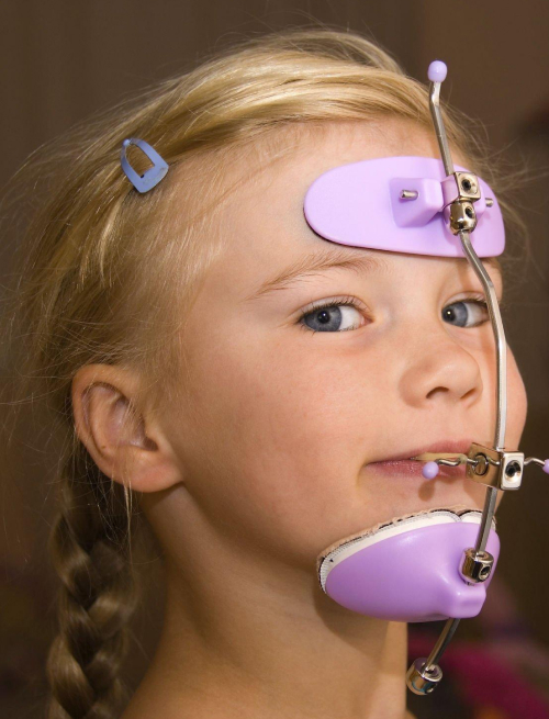 orthodontic