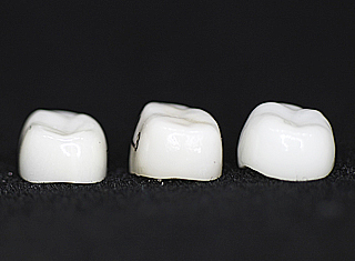 dent1